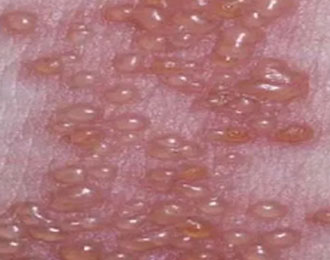 Антибактериальная жидкость Чжучжулю 4 (2)