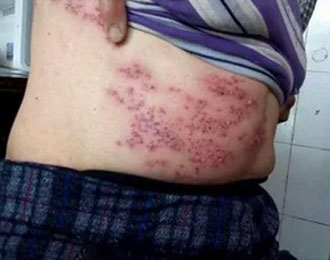 Антибактериальная жидкость Чжучжулю 4 (3)