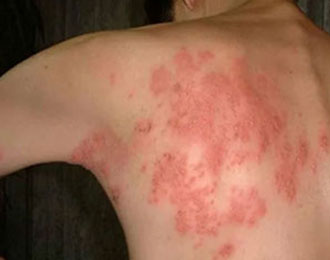 Антибактериальная жидкость Чжучжулю 4 (5)