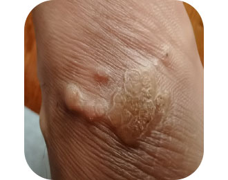 Антибактериальная жидкость Чжэнюкан 7 (5)