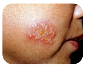 Антибактериальная жидкость для кожи Чжэнюкан (1)