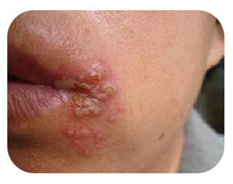 Антибактериальная жидкость для кожи Чжэнюкан (2)