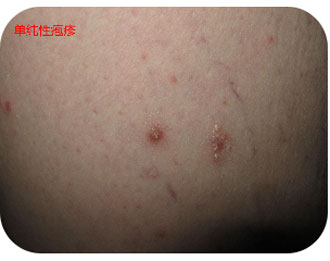 Антибактериальная жидкость для кожи Чжэнюкан (3)