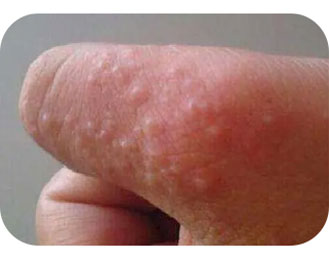 Антибактериальная жидкость для кожи Чжэнюкан (4)